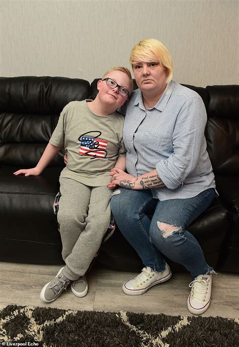 down syndrome nude, nude down syndrome, down syndrome blowjob, down syndrome fuck, down syndrome pussy, sexy down syndrome